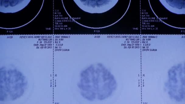 4k Doctors study head PET-ct skull brain scan X-ray film for analysis ...