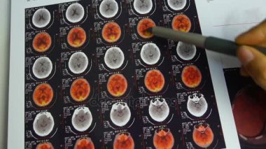 Doktor çalışma renk baş pet-BT, kafatası beyin X-ray.