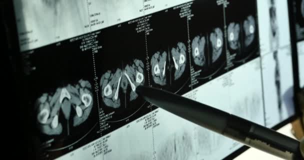 4 k 의사 공부 두개골 두뇌 analysis.health 의료 병원에 대 한 x 선 필름. — 비디오