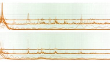 4 k borsa trend analiz istatistik verileri kalp atışı darbe EKG kılavuz çizgileri.