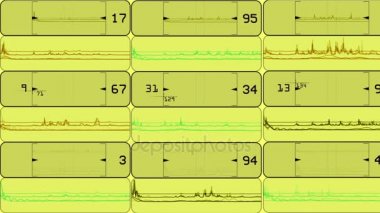 4 k EKG inceden inceye gözden geçirmek algılama numarası, borsa trend analizi yazılım arayüzü.