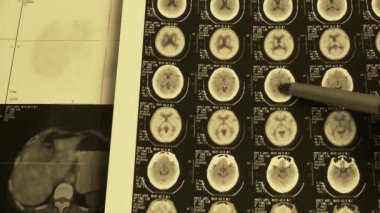 Doktor çalışma renk baş ve vertebra pet-BT, kafatası beyin X-ray.