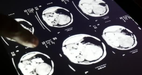 4k Doctor touch PET-CT X-ray film sur écran tactile ipad app logiciel pour l'analyse 