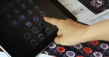 ipad, baş ve organ üzerinde 4 k doktor çalışma MRI tarayıcı pet-BT.