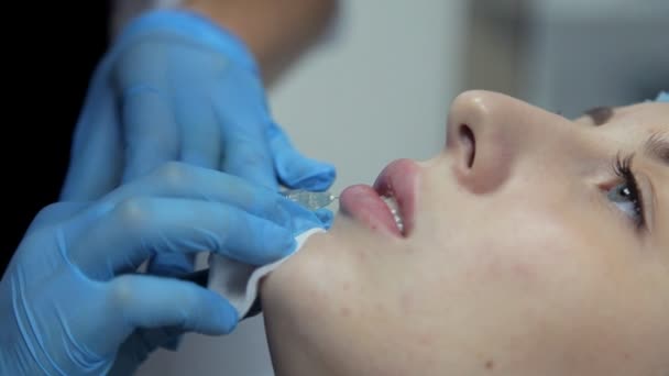 In the clinic, a medical cosmetologist injects Botox with a girl to increase her lips. Close-up. — Stock Video