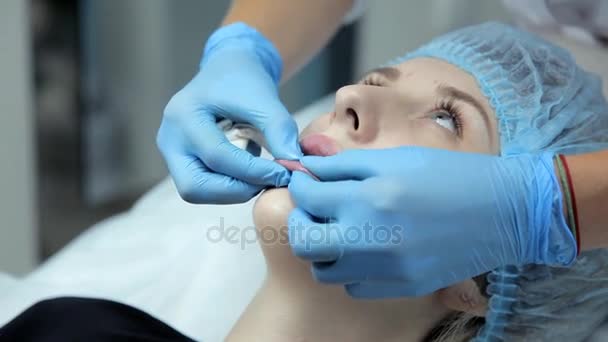 De schoonheidsspecialiste glad botox in de lippen van een jong meisje na de injectie. Lip vergroting procedure. — Stockvideo