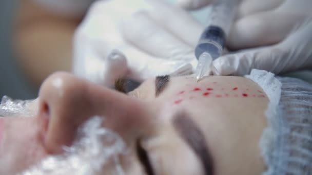In de kliniek voert de schoonheidsspecialist een procedure om te herstellen van de processen in de huid. Biorevitalization — Stockvideo