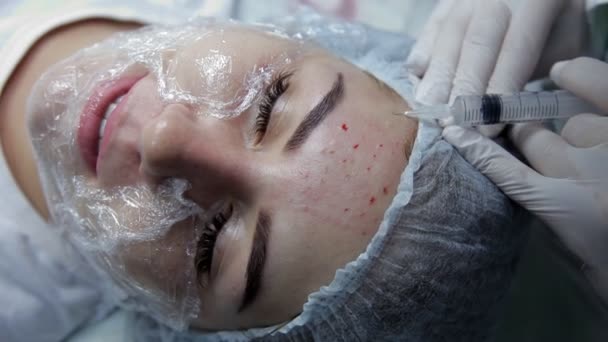 Im Schönheitssalon spritzt der Kosmetiker dem Mädchen zur Hautverjüngung eine Spritze ins Gesicht — Stockvideo