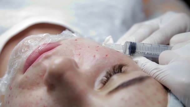 Kosmetolog pęknięcia twarzy klienta z kwasu hialuronowego, aby przywrócić strukturę skóry — Wideo stockowe