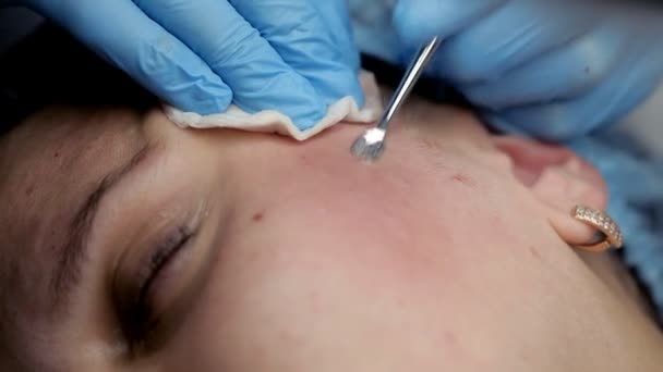 Mechanische Gesichtsreinigung im Schönheitssalon — Stockvideo