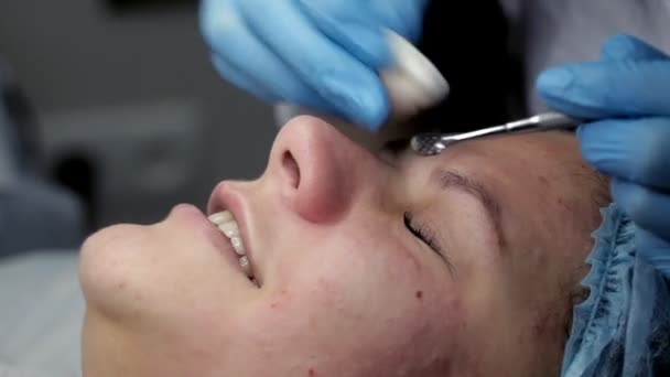 De schoonheidsspecialiste maakt een reiniging van de neus gebied tijdens de procedure van mechanische gezichtsreiniging — Stockvideo