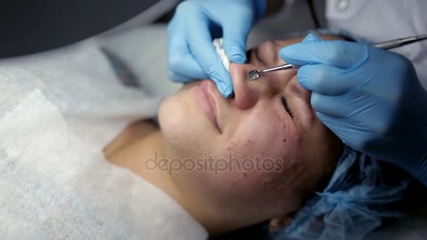 The beautician makes a cleansing of the nose area during the procedure of mechanical facial cleansing — Stock Video