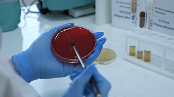 各种细菌和微生物的细菌作物由戴手套的实验室工作人员进行。 用特殊针头播种在特殊的培养皿上。 实验室 — 图库视频影像