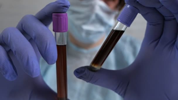 Σύγκριση αίματος μολυσμένου με κορωνοϊό με καθαρό αίμα. Ένας γιατρός εξετάζει την αντίδραση ενός κορωνοϊού σε ένα εμβόλιο.. — Αρχείο Βίντεο