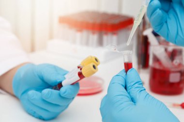 Research and development concept, Laboratory scientist researching covid-19(corona virus) vaccine at laboratory.