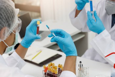 Research and development concept, Laboratory scientist researching covid-19(corona virus) vaccine at laboratory.