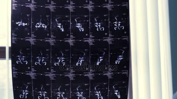 Imagen de la radiografía de la columna vertebral — Vídeos de Stock