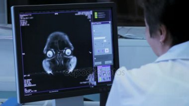 Kadın doktor hastanede tomografi beyin monitörde araştırıyor.