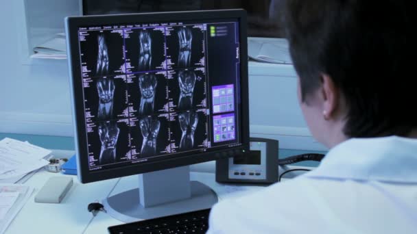 Kadın doktor hastane kaşifler monitör yakın çekim x-ray görüntüleri — Stok video