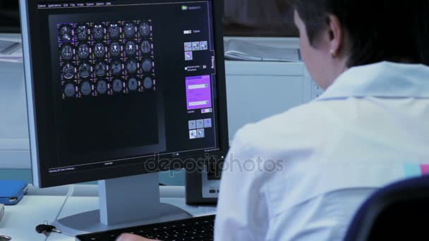 O médico examina as imagens cerebrais em um computador — Vídeo de Stock