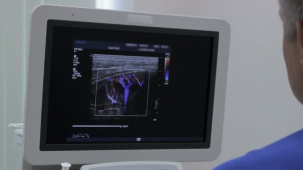 医生看着监视器，超声检查人 — 图库视频影像