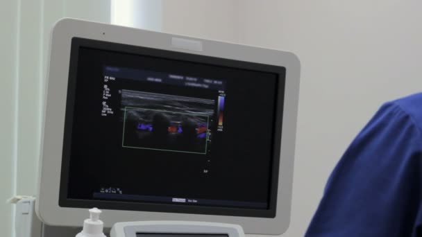 Primer plano del monitor del dispositivo de ultrasonido — Vídeo de stock