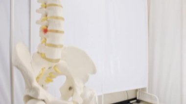 Yapay tıbbi düzen vertebra omurga insan