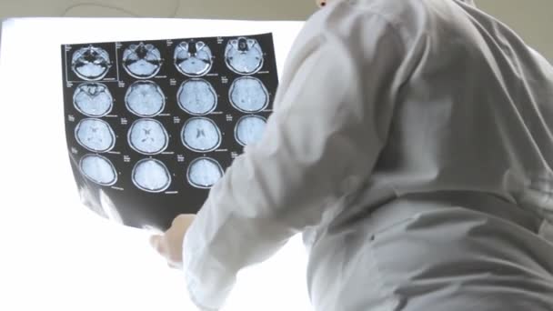 De arts houdt in zijn handen een Mri-scan van de hersenen, diagnose — Stockvideo