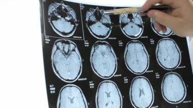 Doktorlar elinde insan beyninin Mr'ı