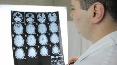 Doktor işaretçi el ile insan beyninin Mr'ı açıklar