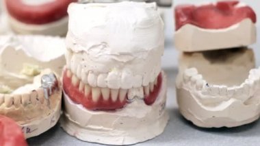 Diş kron jaws modellerinde