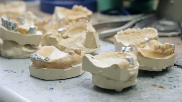 Prótesis de dentista de escritorio, modelos de mandíbulas — Vídeo de stock