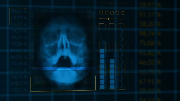 Balayage d'un crâne humain, interface hud bouclée équipement médical 