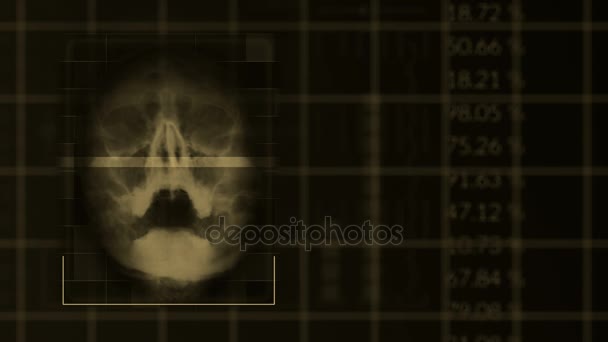 Scan of a human skull, looped brown hud interface medical equipment — Stock Video