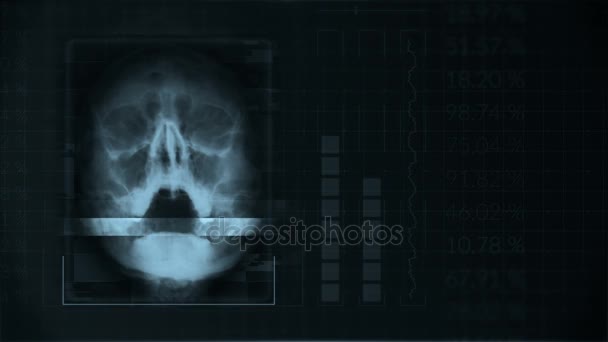 Skanna av en mänsklig skalle, loopas grå hud gränssnitt medicinsk utrustning — Stockvideo