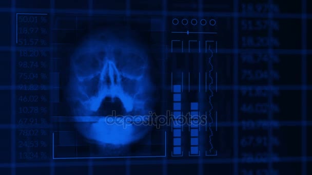 Escaneo de un cráneo humano, equipo médico de interfaz hud azul en bucle — Vídeo de stock