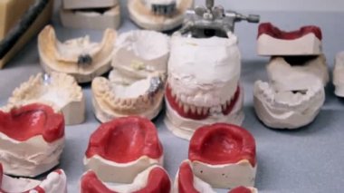 Resepsiyon dişçi prosthetist, çok sayıda eklenti jaws