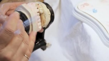 Diş hekimi prosthetist boyalar takma diş çene