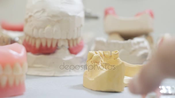 The doctor wears a dental prosthesis on the model of the jaw in the dental laboratory — Stock Video