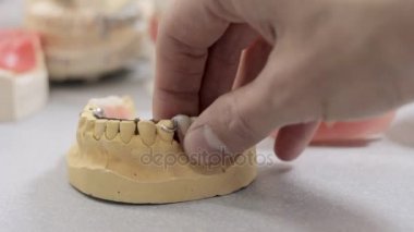 Bir model bir adamın çene bir diş taç kaldırmak ve takma diş almak