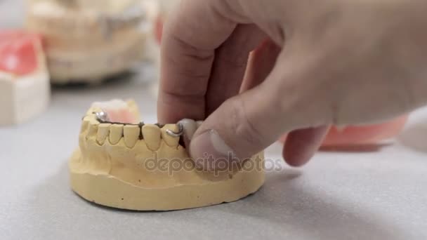 Un modelo de la mandíbula de un hombre quitar una corona dental, y tomar dientes falsos — Vídeos de Stock