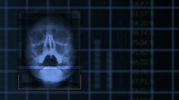 Scan of a human skull, looped Blue hud interface medical equipment — Stock Video