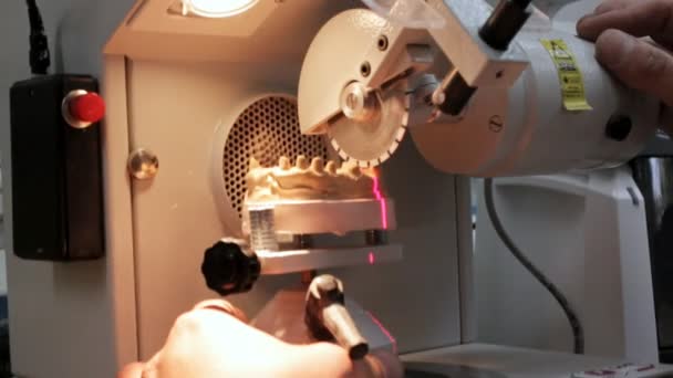 Doctor in de tandheelkundige kaak prothesemaker past zorgvuldig de cirkelzaag te snijden van de prothese — Stockvideo