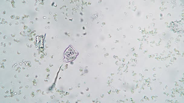 Inusoria vorticella 는 물에 있는 박테리아를 먹고 산다 — 비디오