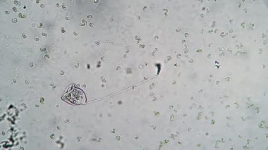 Uzun infusoria bir su akışı yaratır ve bakterilerle beslenir.