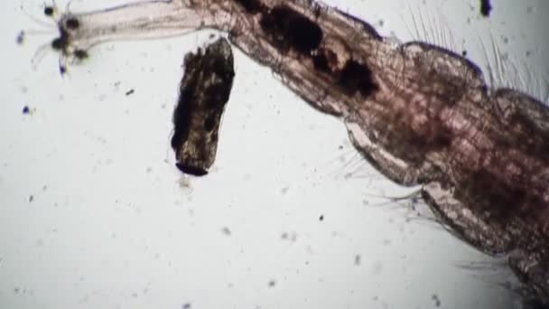Stuhlgang des Mikroorganismus vom Wurm im Mikroskop — Stockvideo