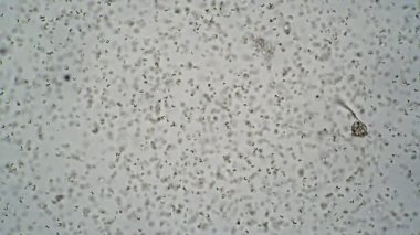 Bir damla suda dönen silikon vorticella serserisi.