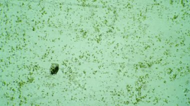 Infusoria Euplotes renkli sulardaki bakteriler tarafından beslenen mytilus