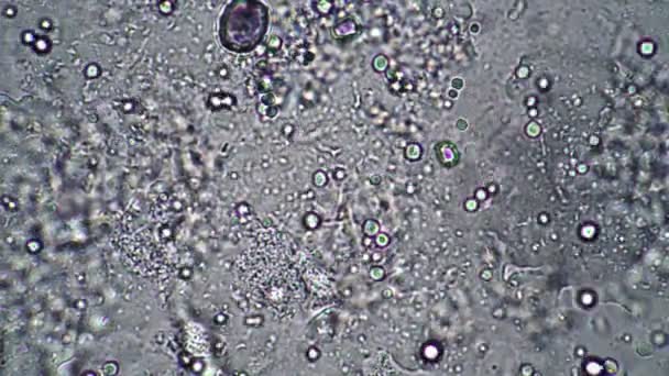 bacilles d'acide lactique dans le levain du lait au microscope 