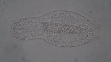 Solucandaki metabolik işlemler Gastrotricha yakın plan